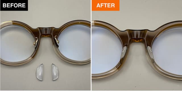 Nose Pad Arm Implants